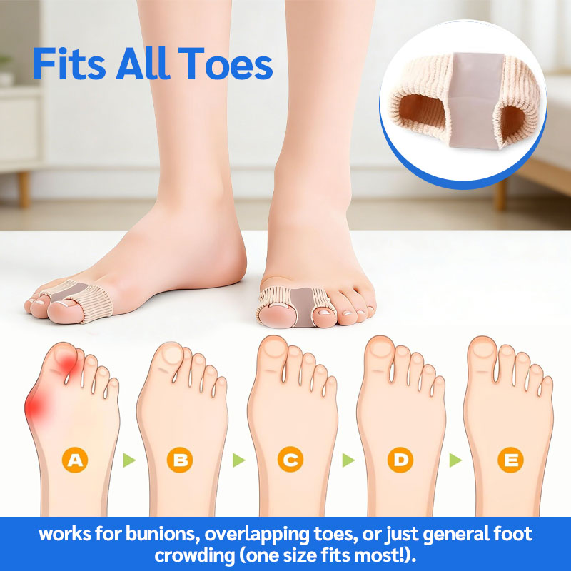 🦶✨ Tåseparator og hallux valgus-korrigerer – Smertefri lindring av hallux valgus og overlappende tå for kvinner og menn! ✨👟