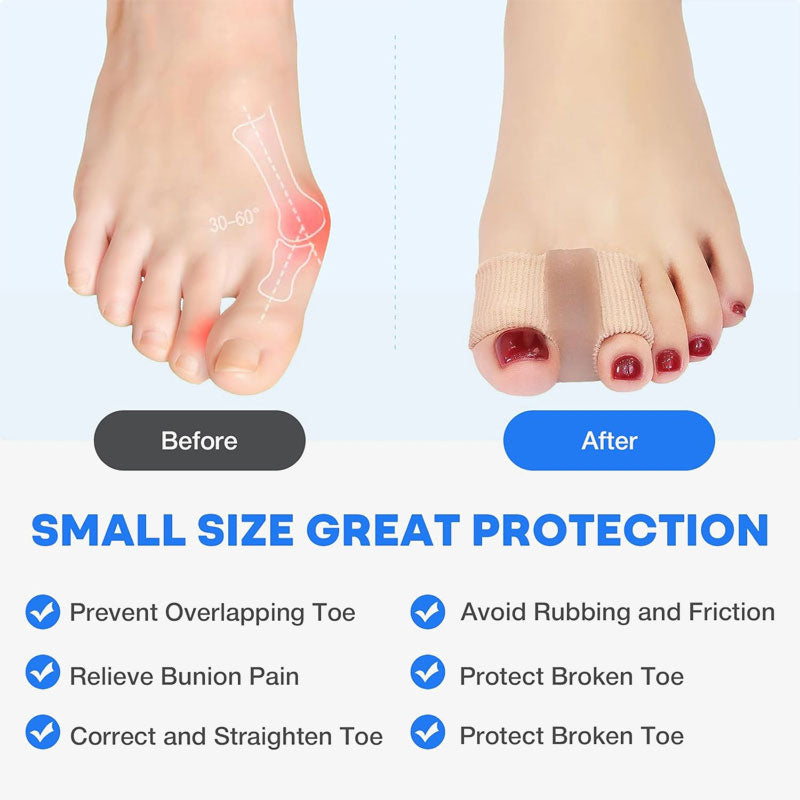 🦶✨ Tåseparator og hallux valgus-korrigerer – Smertefri lindring av hallux valgus og overlappende tå for kvinner og menn! ✨👟